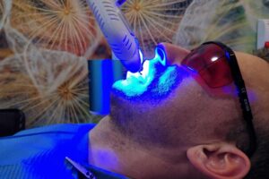 branqueamento dentes algarve