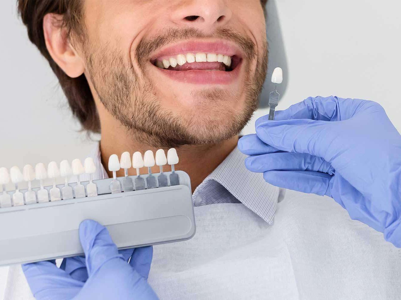 blanchiment des dents