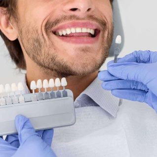 blanchiment des dents