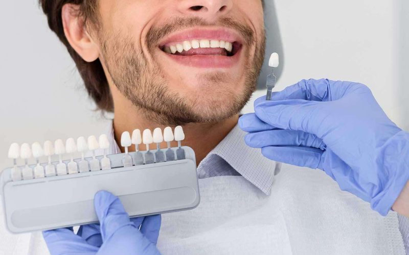blanchiment des dents