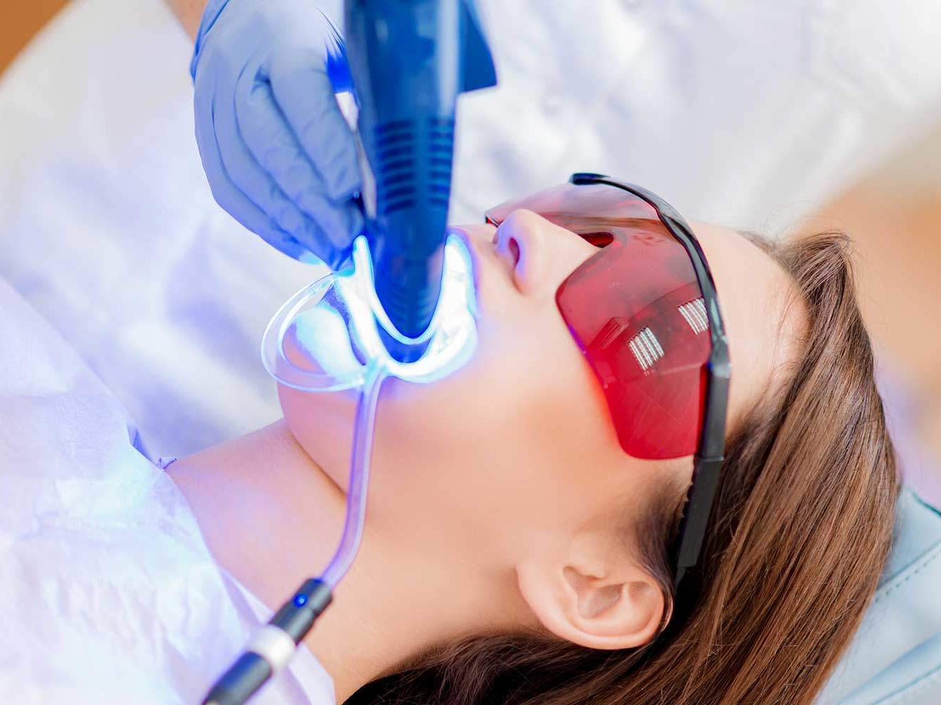 Branqueamento Dentário a laser em Almancil, Algarve