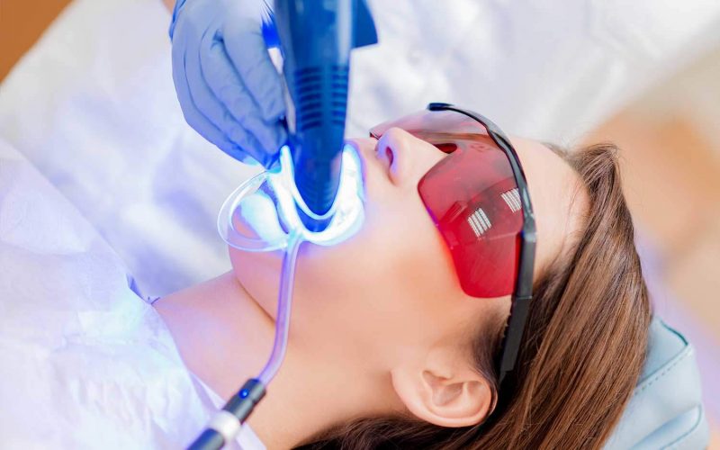 Branqueamento Dentário a laser em Almancil, Algarve