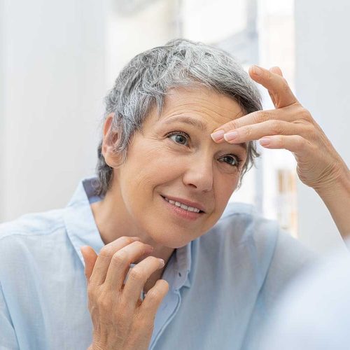 fio sustentação PDO Thread Lift