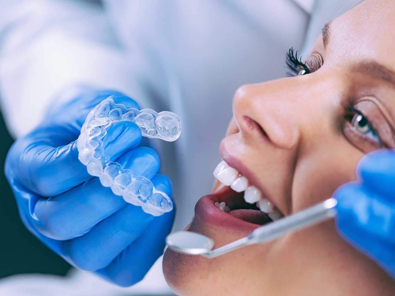 Invisalign Treatment in Almancil, Faro, Algarve : Aligneurs Invisibles
