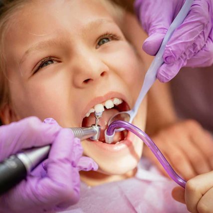 odontopediatria dentes crianças
