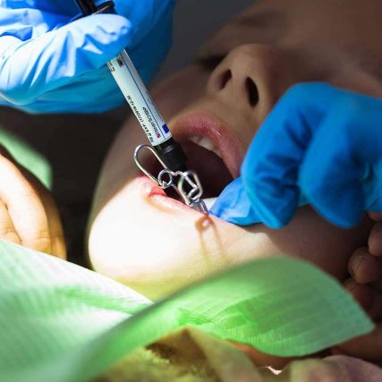 odontopediatria-dentes especialista crianças