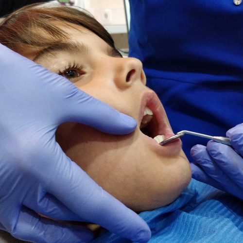 odontopediatria dentista crianças