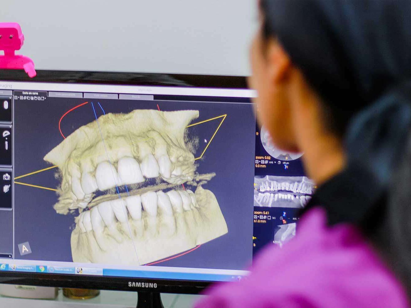 tomografia-3d-dentes-paciente