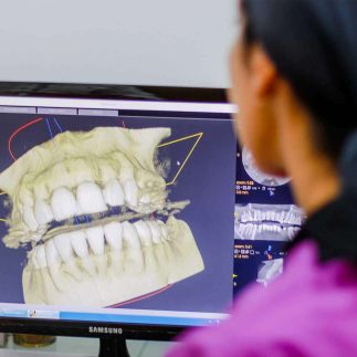tomografia-3d-dentes-paciente