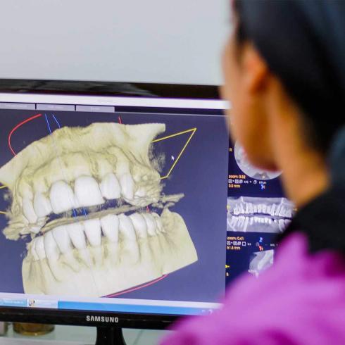 tomografia-3d-dentes-paciente