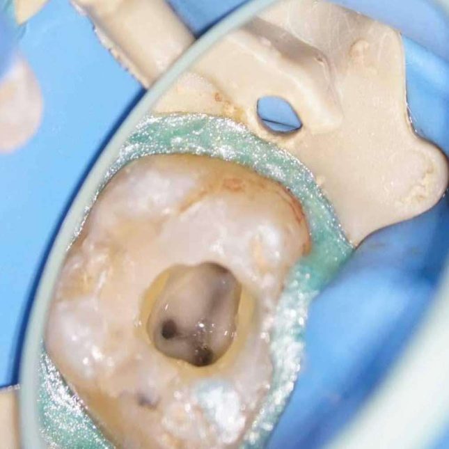 microscopia endodontia