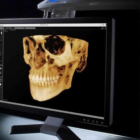 tomografia-3d-maxilar-paciente