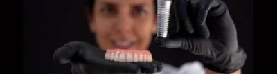 implantes dentarios