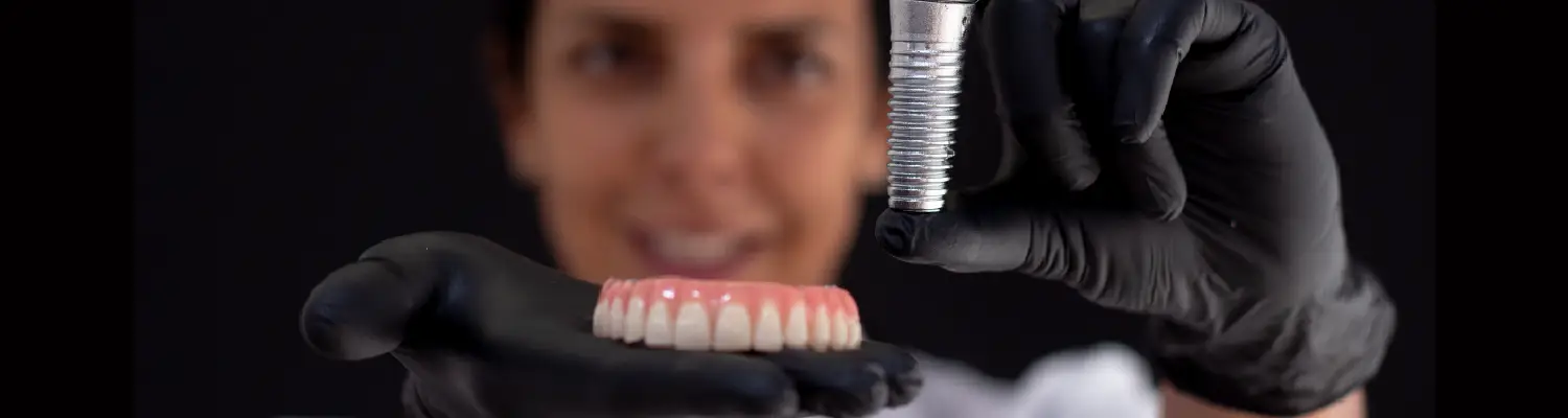 implantes dentarios