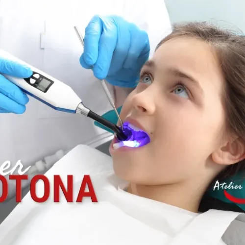 fotona-laser-dentario-criancas