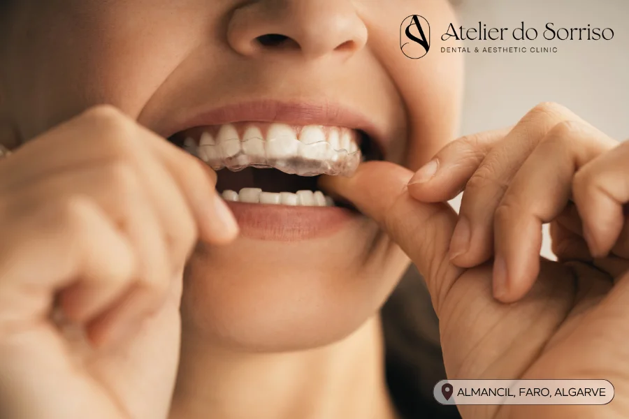 dentista-invisalign-algarve-faro-almancil-01 dentista-invisalign-algarve-faro-almancil-01