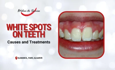 dentist white spots teeth treatments dentist white spots teeth treatments