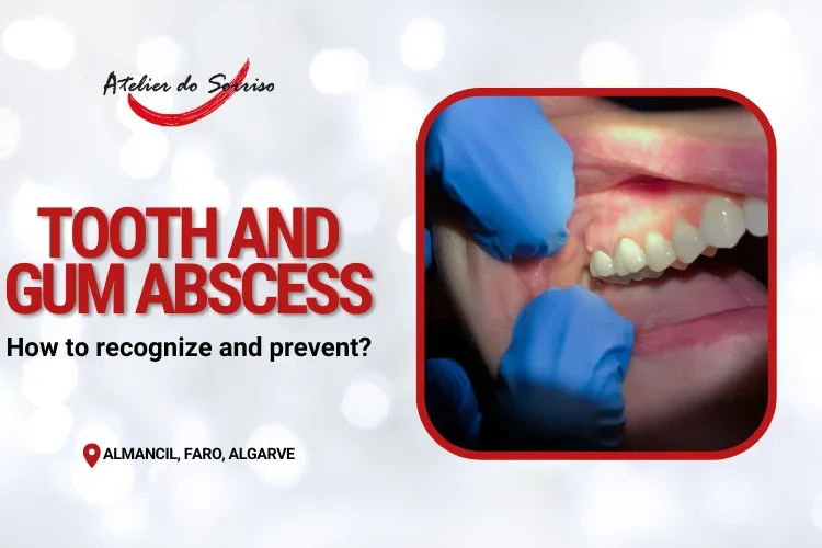 tooth-abscess-gum-abscess-causes-treatments