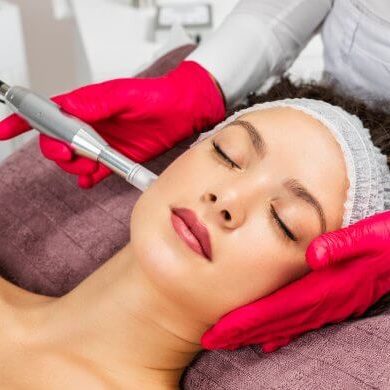microagulhamento dermapen microneedling no Algarve
