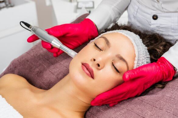 microagulhamento dermapen microneedling no Algarve