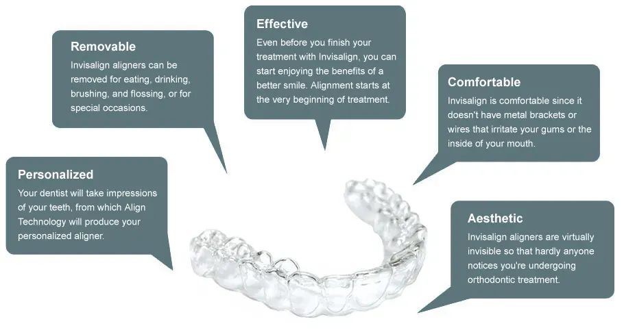 Advantages of Invisalign Appliance
