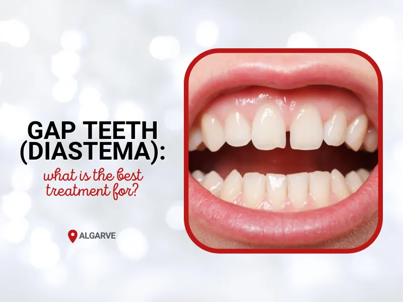 close gap teeth treatment diastema algarve