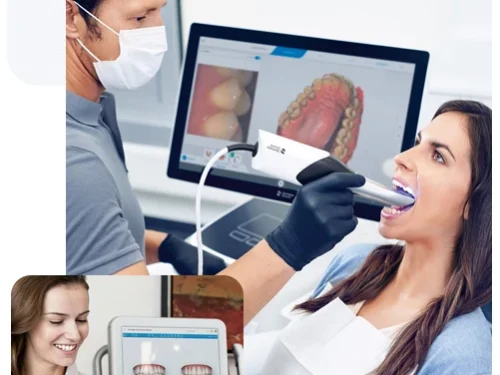 invisalign-3d-scan-plan-treatment
