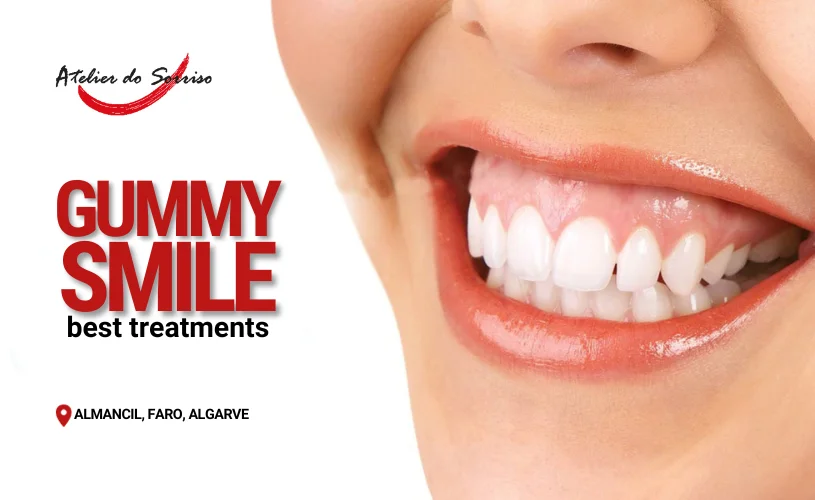 gummy smile treatments algarve faro almancil