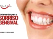 tratamentos-sorriso-gengival-almancil-faro-algarve