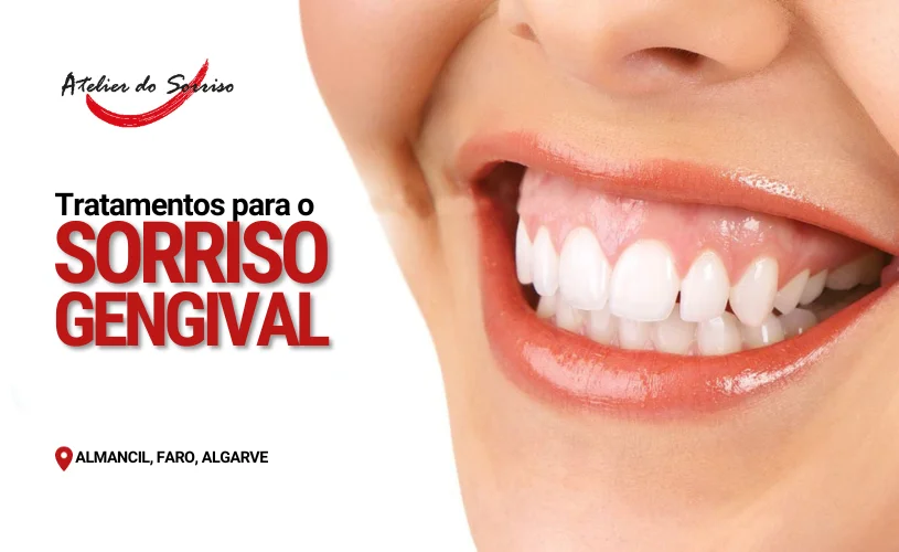 tratamentos-sorriso-gengival-almancil-faro-algarve tratamentos-sorriso-gengival-almancil-faro-algarve