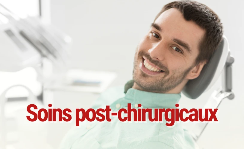 ebook Guide pratique des soins post-opératoires : Soins après une chirurgie dentaire