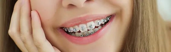 traditional-braces-almancil-faro-algarve-01