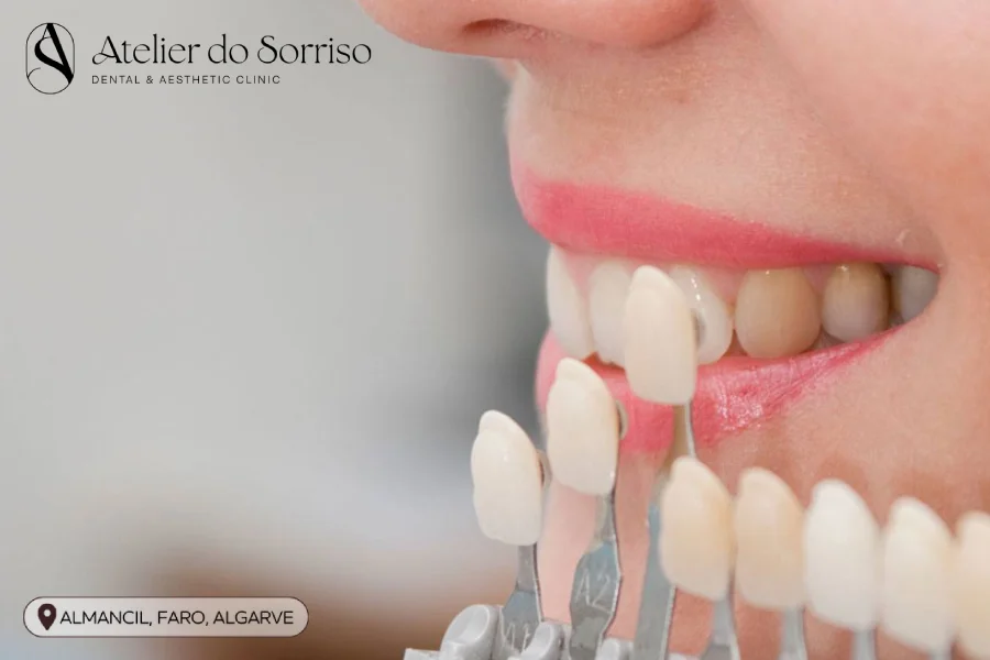 tratar dente escurecido algarve faro almancil