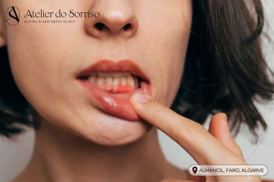 dentista tratamento doencas periodontais algarve faro almancil