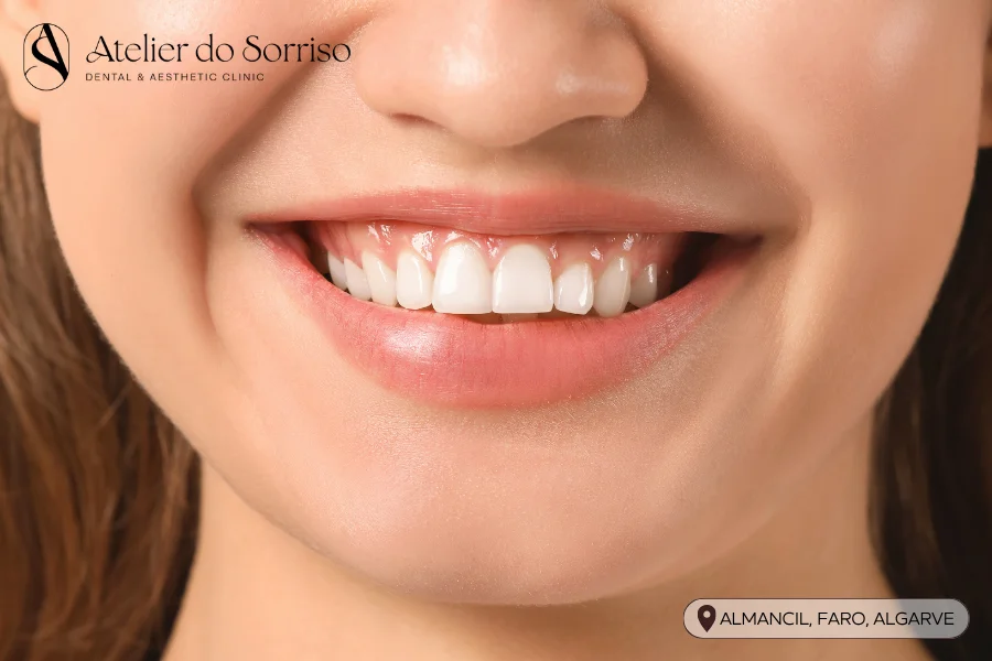 tratamento sorriso gengival algarve faro almancil