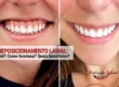 antes-depois-reposicionamento-labial-algarve