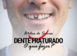 dente-fraturado-caiu