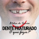 dente-fraturado-caiu