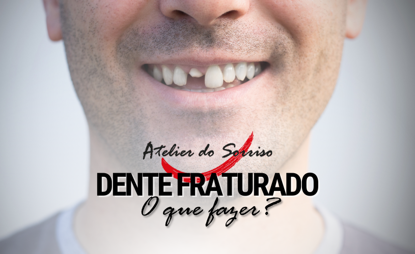 dente fraturado caiu